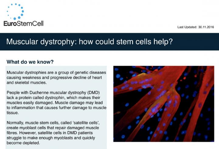 Muscular dystrophy: how could stem cells help? | Eurostemcell